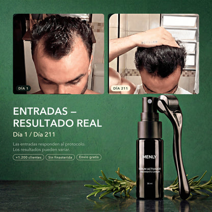 Entradas, resultado real: día 1 y día 211
